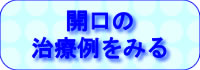 開口の治療例をみる