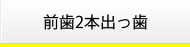 前歯2本出っ歯