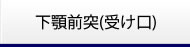 下顎前突(受け口)