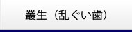 叢生(乱ぐい歯)