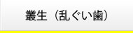 叢生(乱ぐい歯)